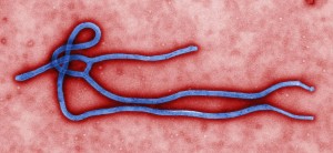 1280px-Ebola_virus_virion